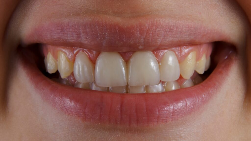 a close-up of a person's mouth